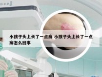 小孩子头上长了一点癣 小孩子头上长了一点癣怎么回事