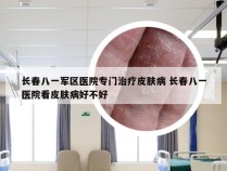 长春八一军区医院专门治疗皮肤病 长春八一医院看皮肤病好不好