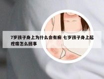 7岁孩子身上为什么会有癣 七岁孩子身上起疙瘩怎么回事