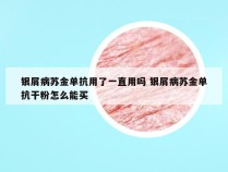 银屑病苏金单抗用了一直用吗 银屑病苏金单抗干粉怎么能买