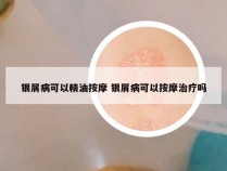 银屑病可以精油按摩 银屑病可以按摩治疗吗