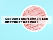 石家庄省四院皮肤科治银屑病怎么样 石家庄省四院皮肤科有个著名专家叫什么