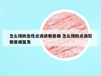 怎么预防急性点滴状银屑病 怎么预防点滴型银屑病复发