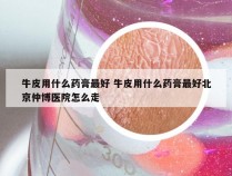 牛皮用什么药膏最好 牛皮用什么药膏最好北京仲博医院怎么走