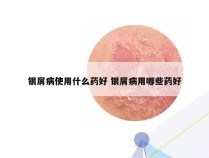 银屑病使用什么药好 银屑病用哪些药好