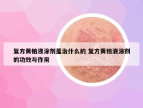 复方黄柏液涂剂是治什么的 复方黄柏液涂剂的功效与作用