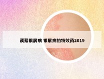 蒺藜银屑病 银屑病的特效药2019