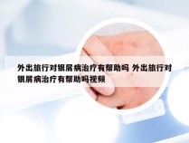 外出旅行对银屑病治疗有帮助吗 外出旅行对银屑病治疗有帮助吗视频