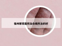 福州那家医院治白癜风治的好