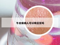 牛皮癣病人可以喝豆浆吗