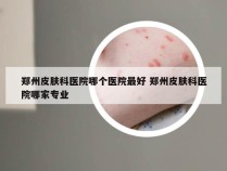 郑州皮肤科医院哪个医院最好 郑州皮肤科医院哪家专业