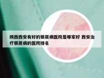 陕西西安有好的银屑病医院是哪家好 西安治疗银屑病的医院排名