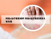 阿维a治疗银屑病甲 阿维a治疗银屑病多久有效果