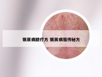 银屑病脐疗方 银屑病祖传秘方