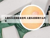 儿童头头皮癣能自愈吗 儿童头皮癣用什么药膏