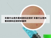 长春什么地方看皮肤科比较好 长春什么地方看皮肤科比较好的医院