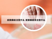 皮肤癣应注意什么 皮肤癣应该注意什么