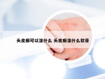 头皮癣可以涂什么 头皮癣涂什么软膏