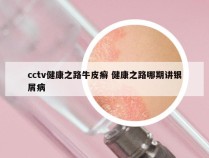 cctv健康之路牛皮癣 健康之路哪期讲银屑病