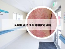 头癣用碘伏 头癣用碘伏可以吗