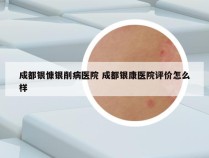 成都银慷银削病医院 成都银康医院评价怎么样