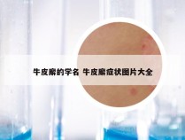 牛皮廨的学名 牛皮廨症状图片大全