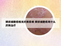 鳞状细胞癌相关抗银屑病 鳞状细胞癌用什么药物治疗