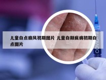 儿童白点癫风初期图片 儿童白颠疯病初期白点图片