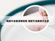 墙面牛皮癣清理简报 墙壁牛皮廨用什么刮