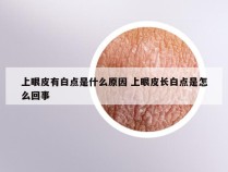 上眼皮有白点是什么原因 上眼皮长白点是怎么回事