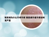 银屑病为什么不疼不痒 银屑病不痛不痒说明更严重