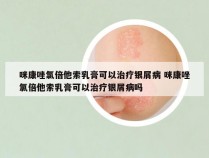 咪康唑氯倍他索乳膏可以治疗银屑病 咪康唑氯倍他索乳膏可以治疗银屑病吗