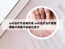 uvb治疗牛皮癣作用 uvb光疗治疗银屑病最大剂量不能超过多少