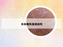 长白癜风是报应吗