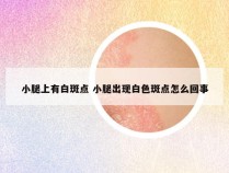 小腿上有白斑点 小腿出现白色斑点怎么回事