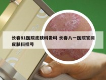 长春81医院皮肤科贵吗 长春八一医院官网皮肤科挂号