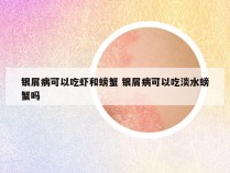 银屑病可以吃虾和螃蟹 银屑病可以吃淡水螃蟹吗