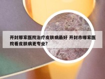 开封那家医院治疗皮肤病最好 开封市哪家医院看皮肤病更专业?