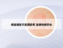 癣益康能不能摸脸呢 益康唑癣药水