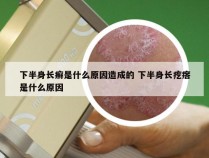 下半身长癣是什么原因造成的 下半身长疙瘩是什么原因