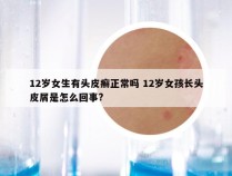 12岁女生有头皮癣正常吗 12岁女孩长头皮屑是怎么回事?