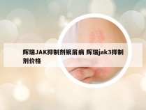 辉瑞JAK抑制剂银屑病 辉瑞jak3抑制剂价格