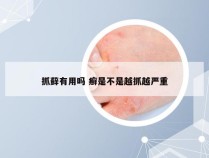 抓藓有用吗 癣是不是越抓越严重