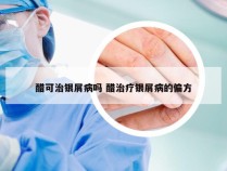 醋可治银屑病吗 醋治疗银屑病的偏方