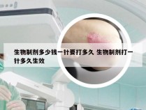 生物制剂多少钱一针要打多久 生物制剂打一针多久生效