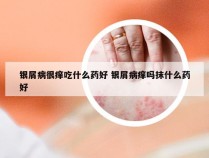 银屑病很痒吃什么药好 银屑病痒吗抹什么药好