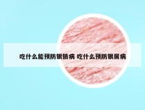 吃什么能预防银销病 吃什么预防银屑病