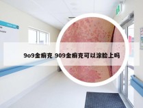 9o9金癣克 909金癣克可以涂脸上吗