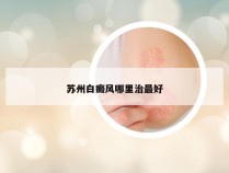 苏州白癜风哪里治最好