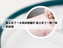 脸上长了一小块白斑图片 脸上长了一块一块的白斑